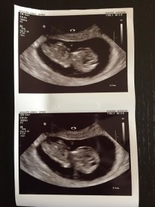 8 Weeks Old - McBaby Ultrasound